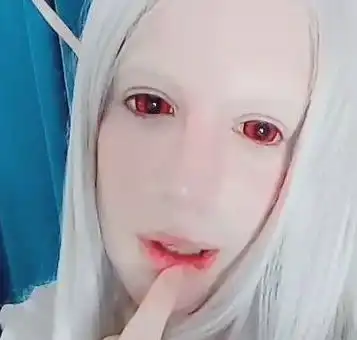 男子不听父母劝解整容成精灵,当大家看到后都合影留念