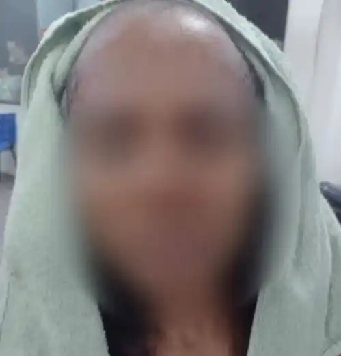 巴西男子怀疑妻子出轨进行家暴,锤击敲头强迫剃发