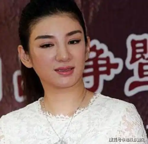 被玻尿酸毁了的9位女星,李小璐的脸太假,而她如同妖怪